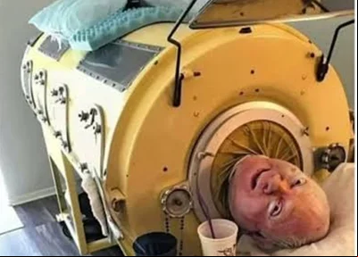 Homem que viveu 71 anos em pulmão de ferro morre de covid nos EUA