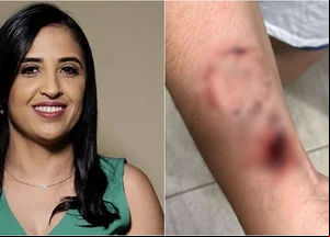 Prefeita Dra. Kaylanne foi acusada de ferir enfermeira com mordidas